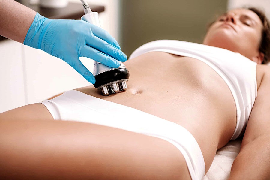 Radio frequency(RF) body sculpting is a non-invasive aimed at reducing fat,  tightening skin, and contouring the body. It utilizes radiofr